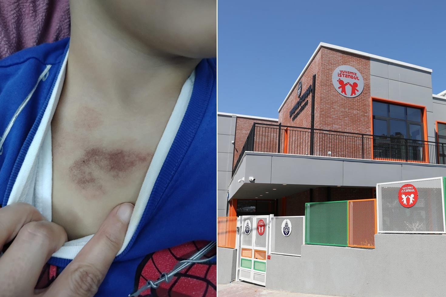 İBB’ye bağlı kreşte yaşananlara ilişkin ifade veren mağdur çocuk: Arkadaşımı dövdü, elbisemi indirip kameraya çekti