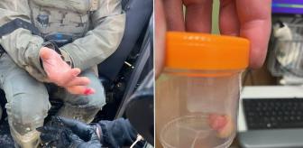 Protestolarda, polisin parmağını ısırarak kopardı