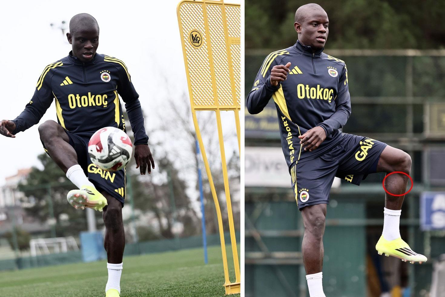 Kante Fenerbahçe’de ilk antrenmanına çıktı Her gören bacağındaki detaya takıldı