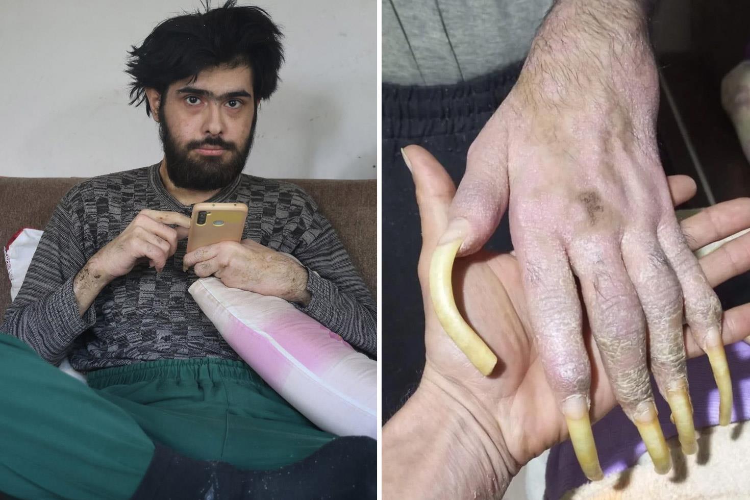 Türkiye’nin konuştuğu Barış’ın yeni işini ve son halini görenler şaşıp kalıyor