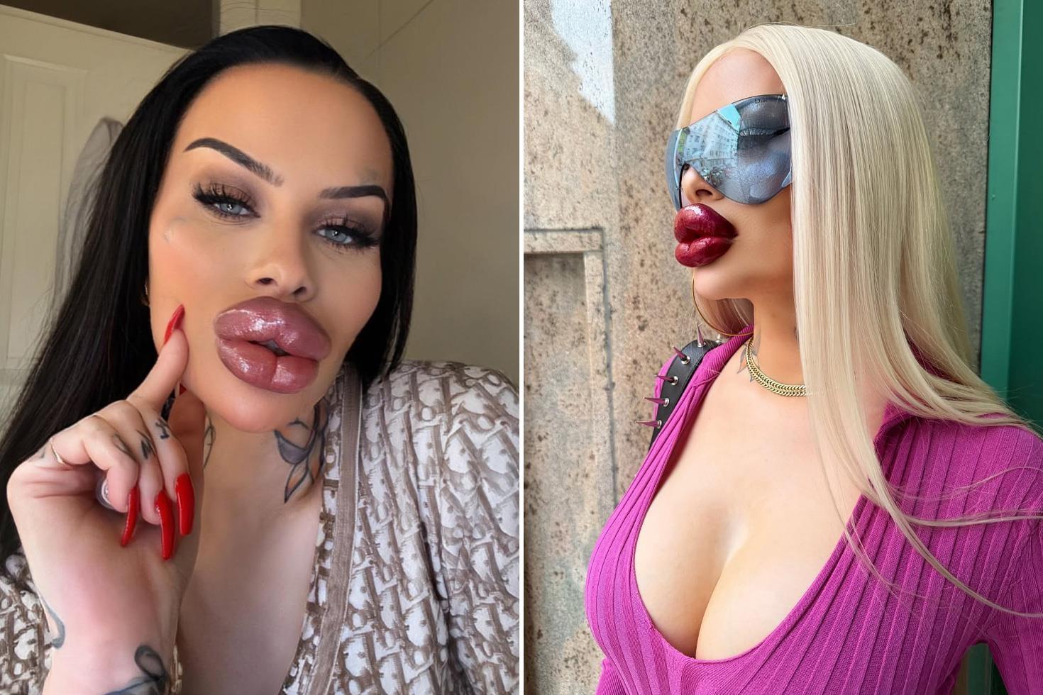 Estetiğe 60 bin dolar harcayan fenomen: Artık ağzımı kapatamıyorum