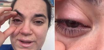 Sadece bulaşık yıkayacaktı! Az kalsın gözünden oluyordu