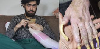 İşte Türkiye'nin konuştuğu Barış'ın son hali