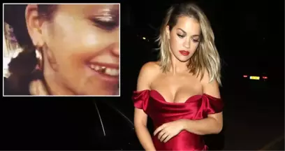 Şarkıcı Rita Ora, Taktırdığı Altın Dişleri Takipçilerine Gösterdi