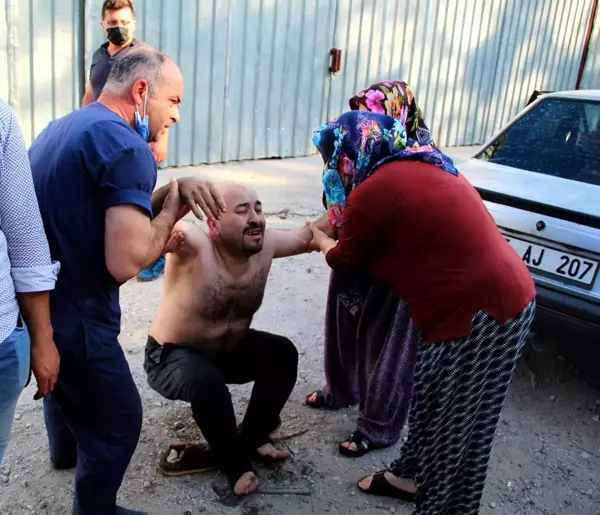 Ekmek teknesini kurtarmak için alevlerin arasında dalan iş yeri sahibinin sırtı yandı