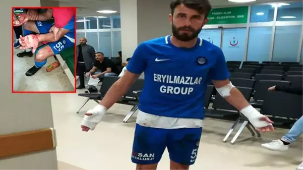 İstanbul'da maç sonunda soyunma odasına girip futbolcuları bıçakladılar