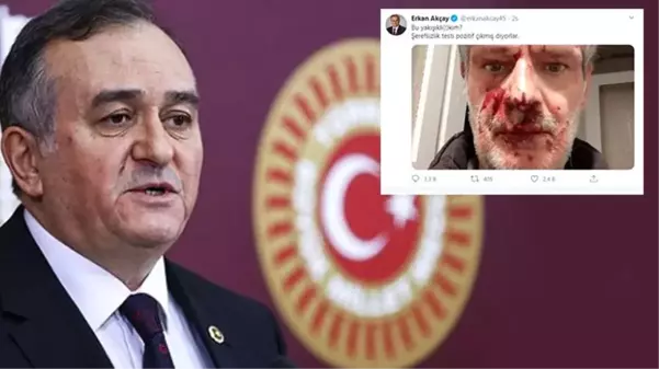 MHP'li Grup Başkanvekili Erkan Akçay, darp edilen yazarın fotoğrafını paylaştı