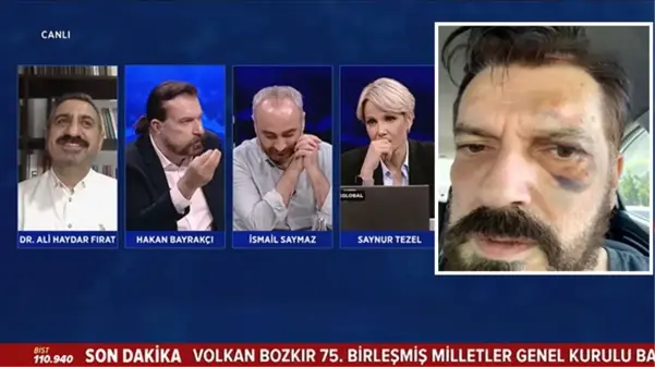 Ünlü anketçi Hakan Bayraktar'dan 1 yıl sonra gelen itiraf: Teke tek çağırdım, 5 kişi gelip saldırdılar