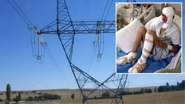 Elektrik akımına kapılan 13 yaşındaki çocuğun ayak tabanları patladı