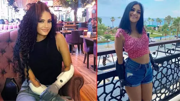 Geçirdiği hastalık nedeniyle iki kolunu ve ayaklarını kaybeden Beyza, çift kol nakli için Almanya'dan Türkiye'ye geldi