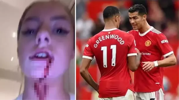 Dünyaca ünlü futbolcu Mason Greenwood, sevgilisine tecavüze kalkıştı! Kendisine karşı koyan kadın tanınmaz halde