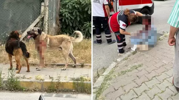 İstanbul'da köpek saldırısına uğrayan kadın gözünü kaybetti