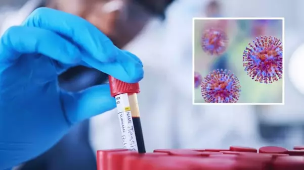 Avustralya'da yüzlerce ölümcül virüs örneği kayboldu
