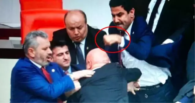 AK Partili vekilin eli, CHP'li Engin Özkoç'a attığı yumruk nedeniyle üç yerden kırıldı